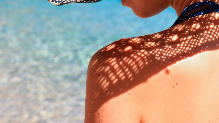 Sünnimärke tuleb elu jooksul juurde – need on healoomulised nahamoodustised.